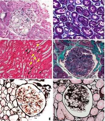 Renal Abnormalities Caused by Canine Distemper Virus Infection in Terminal Patients